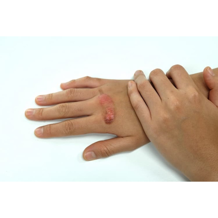 REPOLAR Abilar® balzám na rány 20g